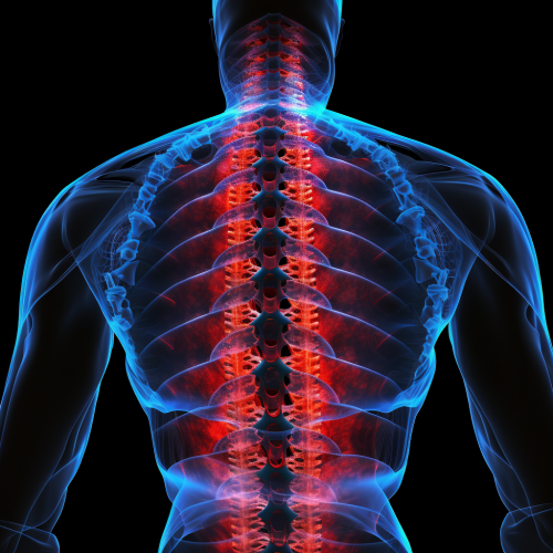 A blue and red x-ray image depicting back pain